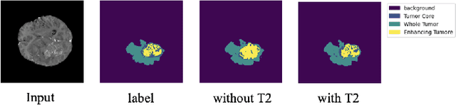 Figure 1 for Unveiling Incomplete Modality Brain Tumor Segmentation: Leveraging Masked Predicted Auto-Encoder and Divergence Learning