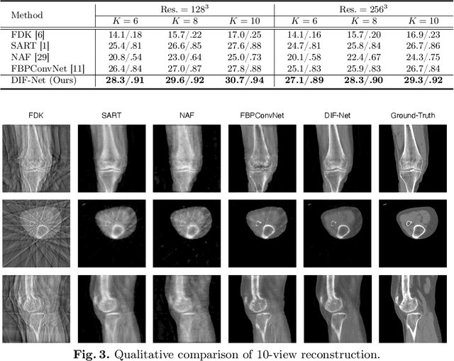 Figure 4 for Learning Deep Intensity Field for Extremely Sparse-View CBCT Reconstruction