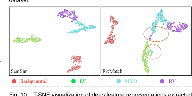 Figure 2 for SemSim: Revisiting Weak-to-Strong Consistency from a Semantic Similarity Perspective for Semi-supervised Medical Image Segmentation