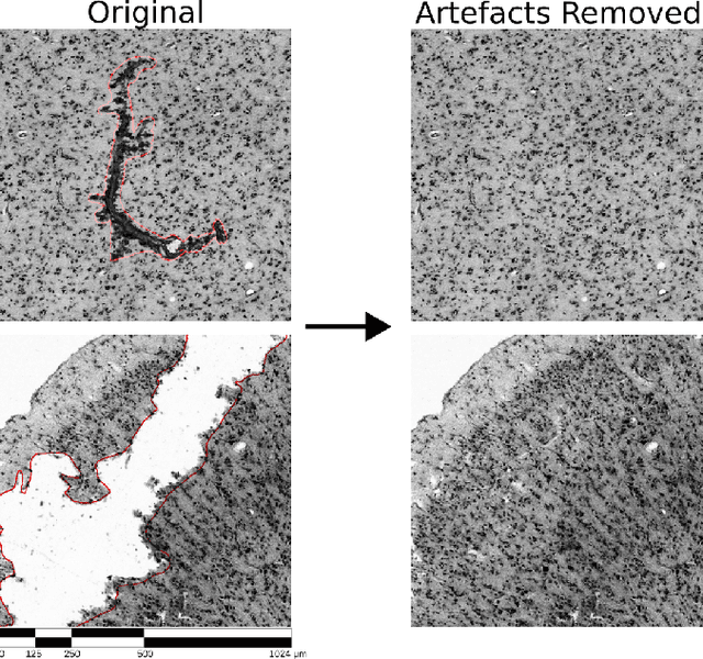 Figure 1 for Denoising Diffusion Probabilistic Models for Image Inpainting of Cell Distributions in the Human Brain