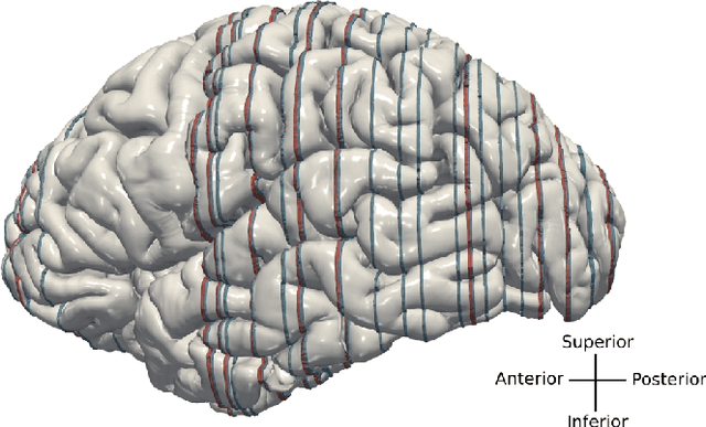 Figure 2 for Denoising Diffusion Probabilistic Models for Image Inpainting of Cell Distributions in the Human Brain