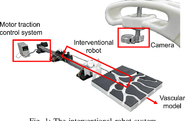 Figure 1 for Pose State Perception of Interventional Robot for Cardio-cerebrovascular Procedures