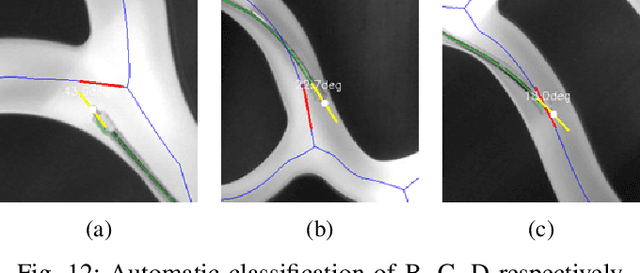 Figure 4 for Pose State Perception of Interventional Robot for Cardio-cerebrovascular Procedures