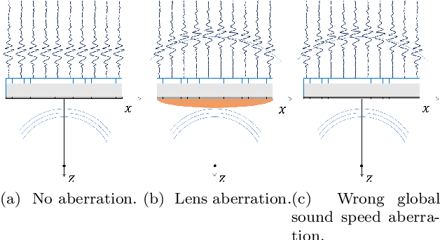 Figure 3 for Coherence Based Sound Speed Aberration Correction -- with clinical validation in obstetric ultrasound