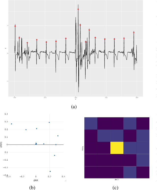 Figure 3 for Enhancing ECG Analysis of Implantable Cardiac Monitor Data: An Efficient Pipeline for Multi-Label Classification