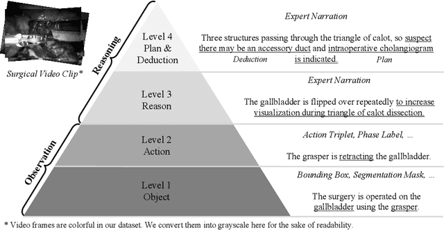 Figure 1 for LLaVA-Surg: Towards Multimodal Surgical Assistant via Structured Surgical Video Learning