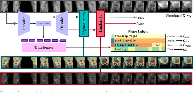 Figure 1 for Pelphix: Surgical Phase Recognition from X-ray Images in Percutaneous Pelvic Fixation