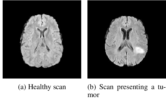 Figure 3 for Detecting Brain Tumors through Multimodal Neural Networks