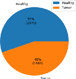 Figure 4 for Detecting Brain Tumors through Multimodal Neural Networks