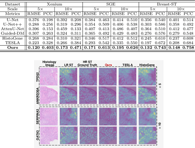 Figure 2 for Cross-modal Diffusion Modelling for Super-resolved Spatial Transcriptomics