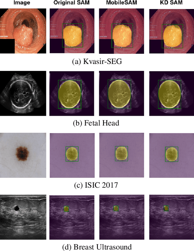 Figure 4 for Efficient Knowledge Distillation of SAM for Medical Image Segmentation