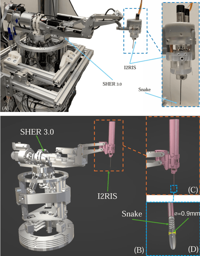 Figure 1 for Model Predictive Path Integral Control of I2RIS Robot Using RBF Identifier and Extended Kalman Filter