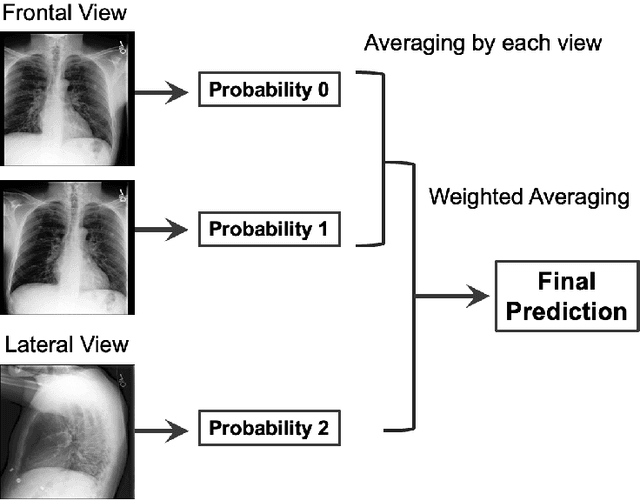 Figure 1 for Ensemble of ConvNeXt V2 and MaxViT for Long-Tailed CXR Classification with View-Based Aggregation