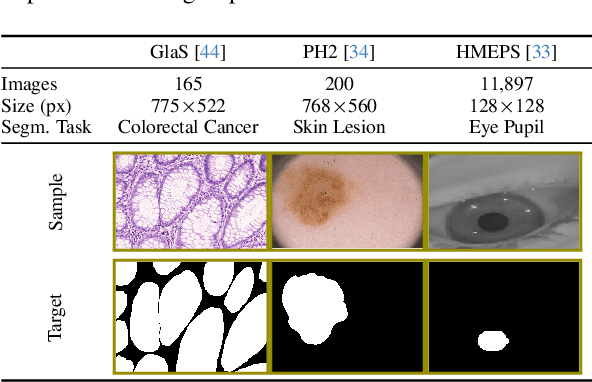 Figure 2 for Biologically-inspired Semi-supervised Semantic Segmentation for Biomedical Imaging