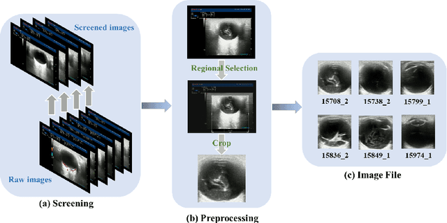 Figure 3 for A Labeled Ophthalmic Ultrasound Dataset with Medical Report Generation Based on Cross-modal Deep Learning