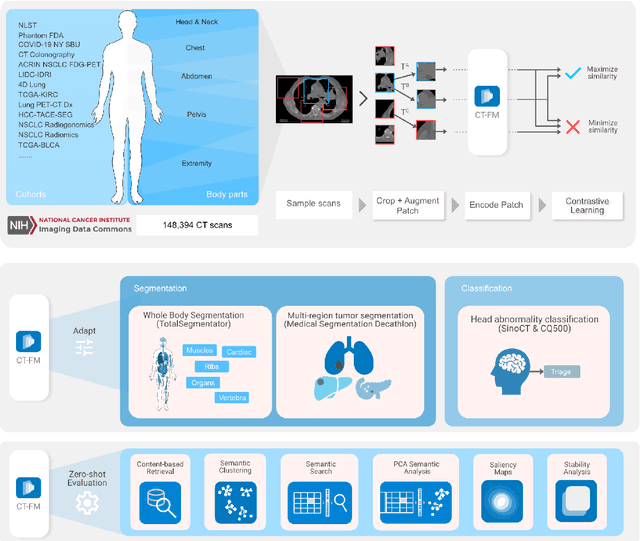 Figure 1 for Vision Foundation Models for Computed Tomography