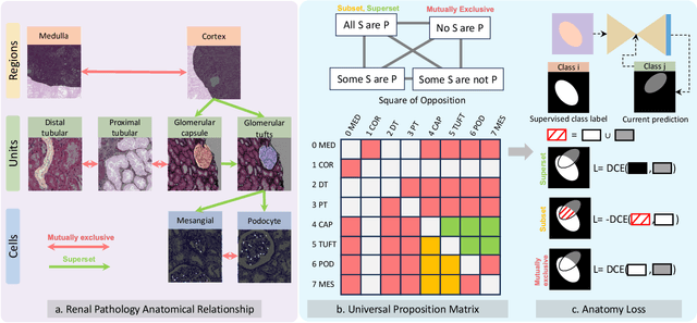 Figure 3 for PrPSeg: Universal Proposition Learning for Panoramic Renal Pathology Segmentation