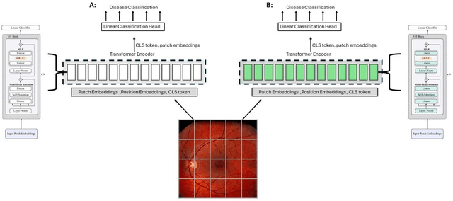 Figure 4 for Block Expanded DINORET: Adapting Natural Domain Foundation Models for Retinal Imaging Without Catastrophic Forgetting