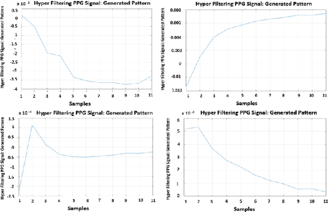 Figure 2 for Car-Driver Drowsiness Assessment through 1D Temporal Convolutional Networks