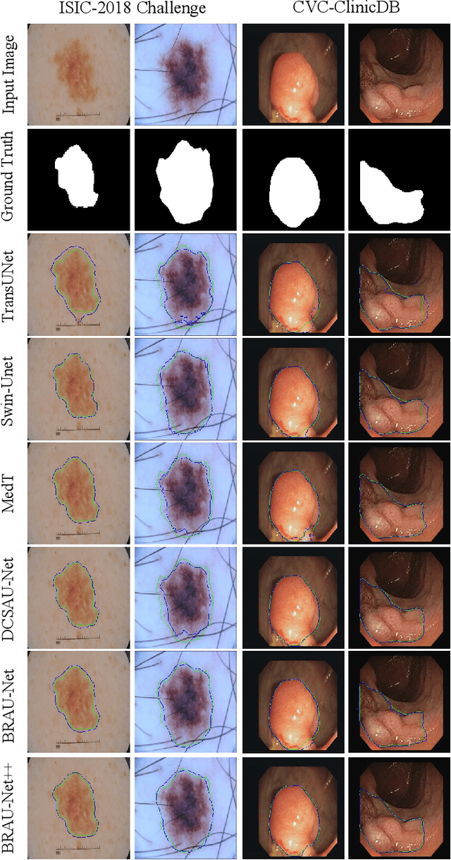 Figure 4 for BRAU-Net++: U-Shaped Hybrid CNN-Transformer Network for Medical Image Segmentation