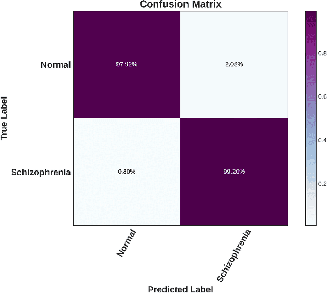 Figure 3 for Wavelet-based Autoencoder and EfficientNet for Schizophrenia Detection from EEG Signals