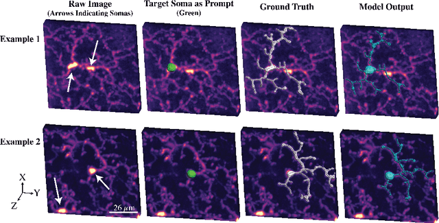 Figure 3 for trAIce3D: A Prompt-Driven Transformer Based U-Net for Semantic Segmentation of Microglial Cells from Large-Scale 3D Microscopy Images