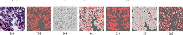 Figure 1 for Dynamic Pseudo Label Optimization in Point-Supervised Nuclei Segmentation