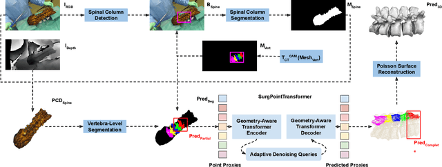 Figure 1 for SurgPointTransformer: Vertebrae Shape Completion with RGB-D Data