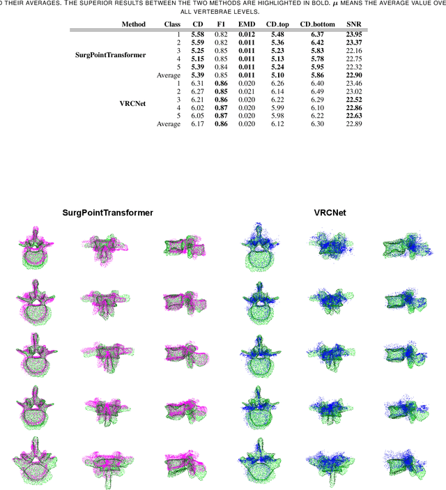 Figure 4 for SurgPointTransformer: Vertebrae Shape Completion with RGB-D Data