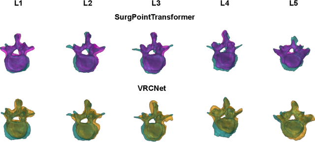 Figure 2 for SurgPointTransformer: Vertebrae Shape Completion with RGB-D Data