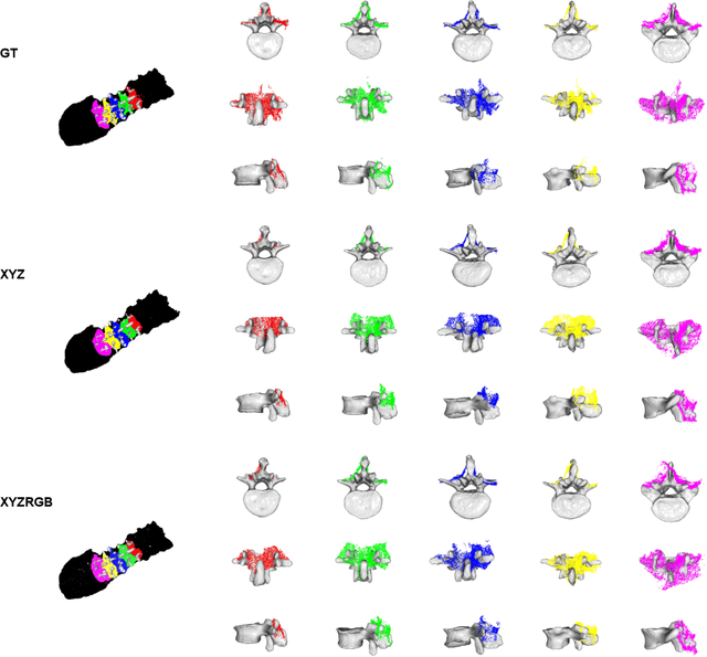 Figure 3 for SurgPointTransformer: Vertebrae Shape Completion with RGB-D Data