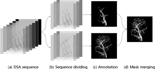 Figure 2 for DIAS: A Comprehensive Benchmark for DSA-sequence Intracranial Artery Segmentation