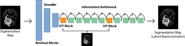 Figure 1 for T1-contrast Enhanced MRI Generation from Multi-parametric MRI for Glioma Patients with Latent Tumor Conditioning