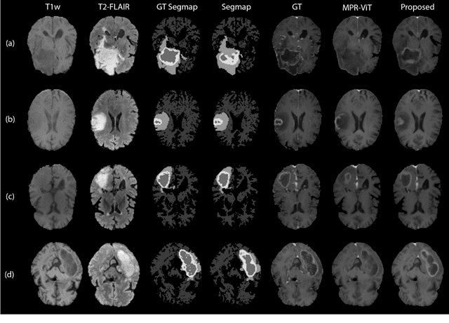 Figure 3 for T1-contrast Enhanced MRI Generation from Multi-parametric MRI for Glioma Patients with Latent Tumor Conditioning