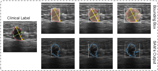 Figure 1 for SAM-Driven Weakly Supervised Nodule Segmentation with Uncertainty-Aware Cross Teaching