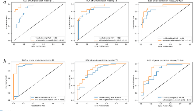 Figure 2 for Glioma Multimodal MRI Analysis System for Tumor Layered Diagnosis via Multi-task Semi-supervised Learning