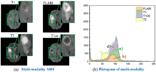 Figure 1 for FgC2F-UDiff: Frequency-guided and Coarse-to-fine Unified Diffusion Model for Multi-modality Missing MRI Synthesis