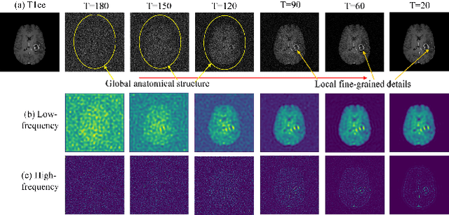 Figure 3 for FgC2F-UDiff: Frequency-guided and Coarse-to-fine Unified Diffusion Model for Multi-modality Missing MRI Synthesis