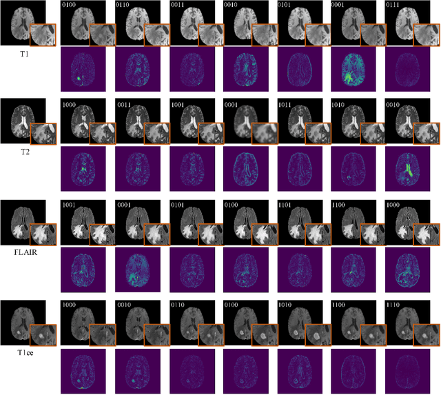 Figure 4 for FgC2F-UDiff: Frequency-guided and Coarse-to-fine Unified Diffusion Model for Multi-modality Missing MRI Synthesis