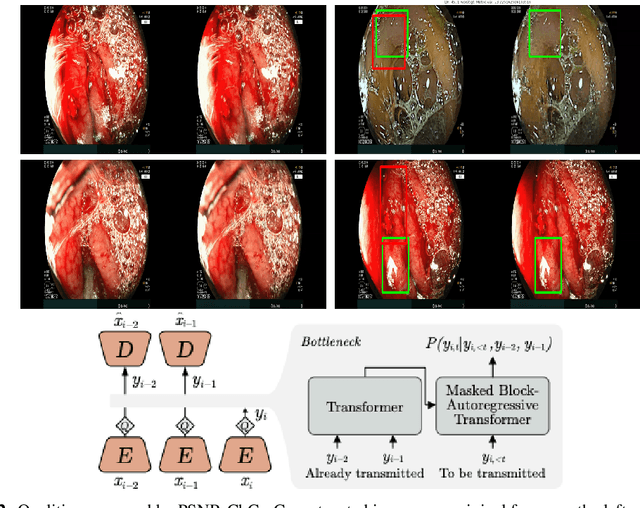 Figure 2 for The Need for Medically Aware Video Compression in Gastroenterology