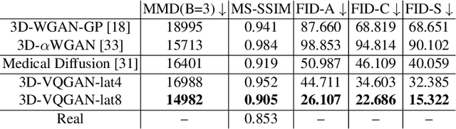 Figure 2 for Generating 3D Brain Tumor Regions in MRI using Vector-Quantization Generative Adversarial Networks