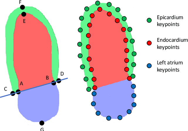 Figure 2 for Towards Robust Cardiac Segmentation using Graph Convolutional Networks