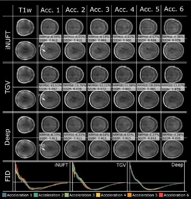 Figure 4 for Deep-ER: Deep Learning ECCENTRIC Reconstruction for fast high-resolution neurometabolic imaging