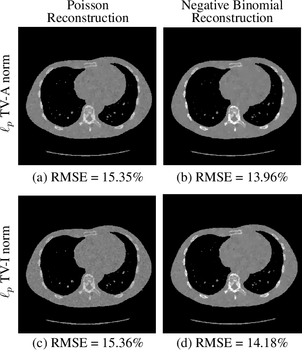 Figure 4 for Sparse Signal Reconstruction for Overdispersed Low-photon Count Biomedical Imaging Using $\ell_p$ Total Variation