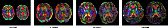 Figure 1 for Streamline tractography of the fetal brain in utero with machine learning