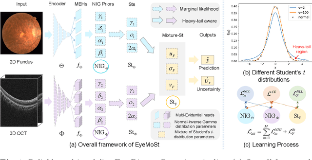 Figure 1 for Reliable Multimodality Eye Disease Screening via Mixture of Student's t Distributions