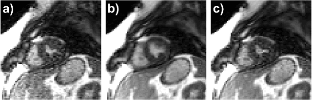 Figure 2 for Deep Learning Assisted Outer Volume Removal for Highly-Accelerated Real-Time Dynamic MRI