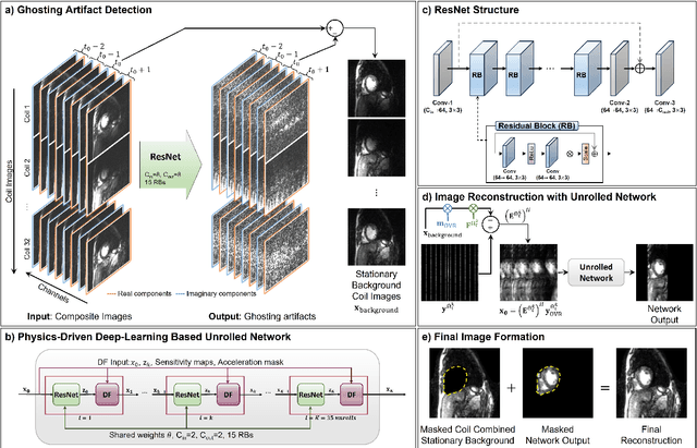 Figure 4 for Deep Learning Assisted Outer Volume Removal for Highly-Accelerated Real-Time Dynamic MRI