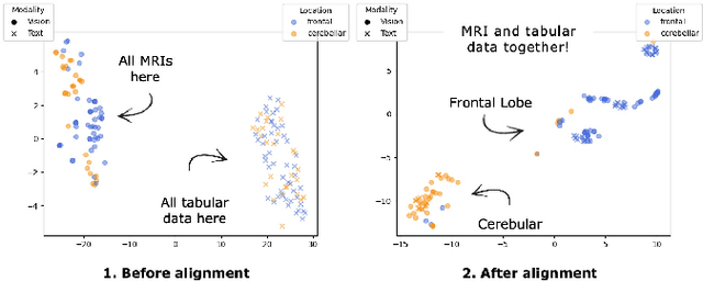 Figure 1 for Revisiting CLIP: Efficient Alignment of 3D MRI and Tabular Data using Domain-Specific Foundation Models