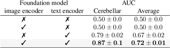 Figure 2 for Revisiting CLIP: Efficient Alignment of 3D MRI and Tabular Data using Domain-Specific Foundation Models